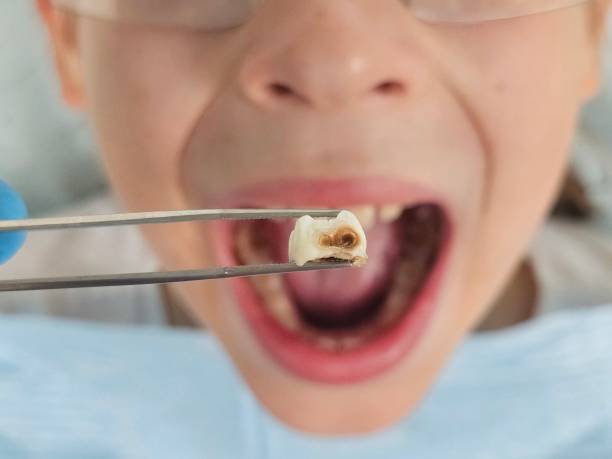 Best Emergency Dental Care for Trauma or Injury in Denver City, TX